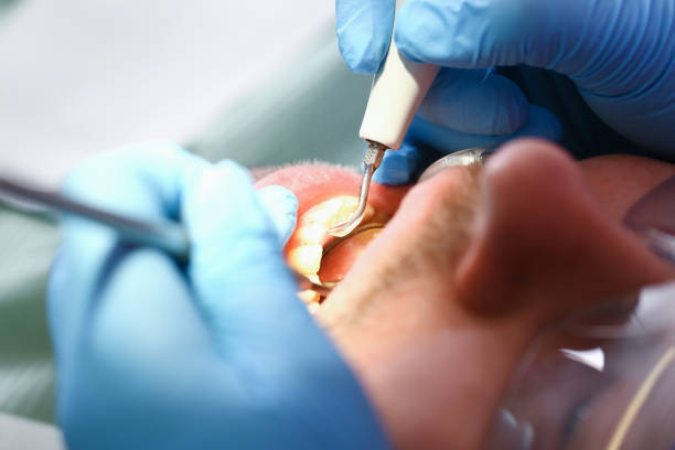 Best Broken Tooth Emergency  in Sleepy Hollow Lake, NY